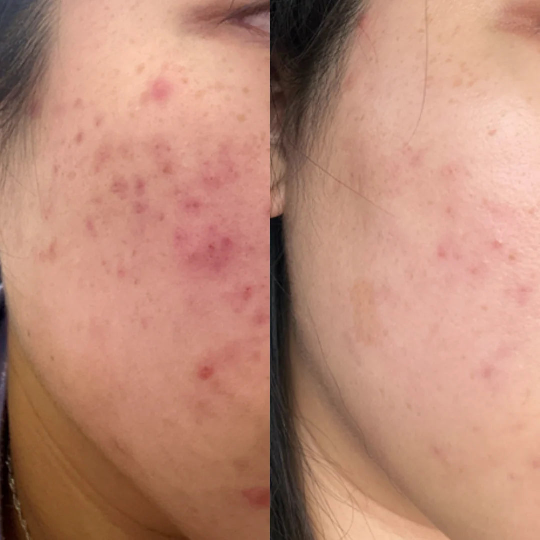 UltraClear Cleanser