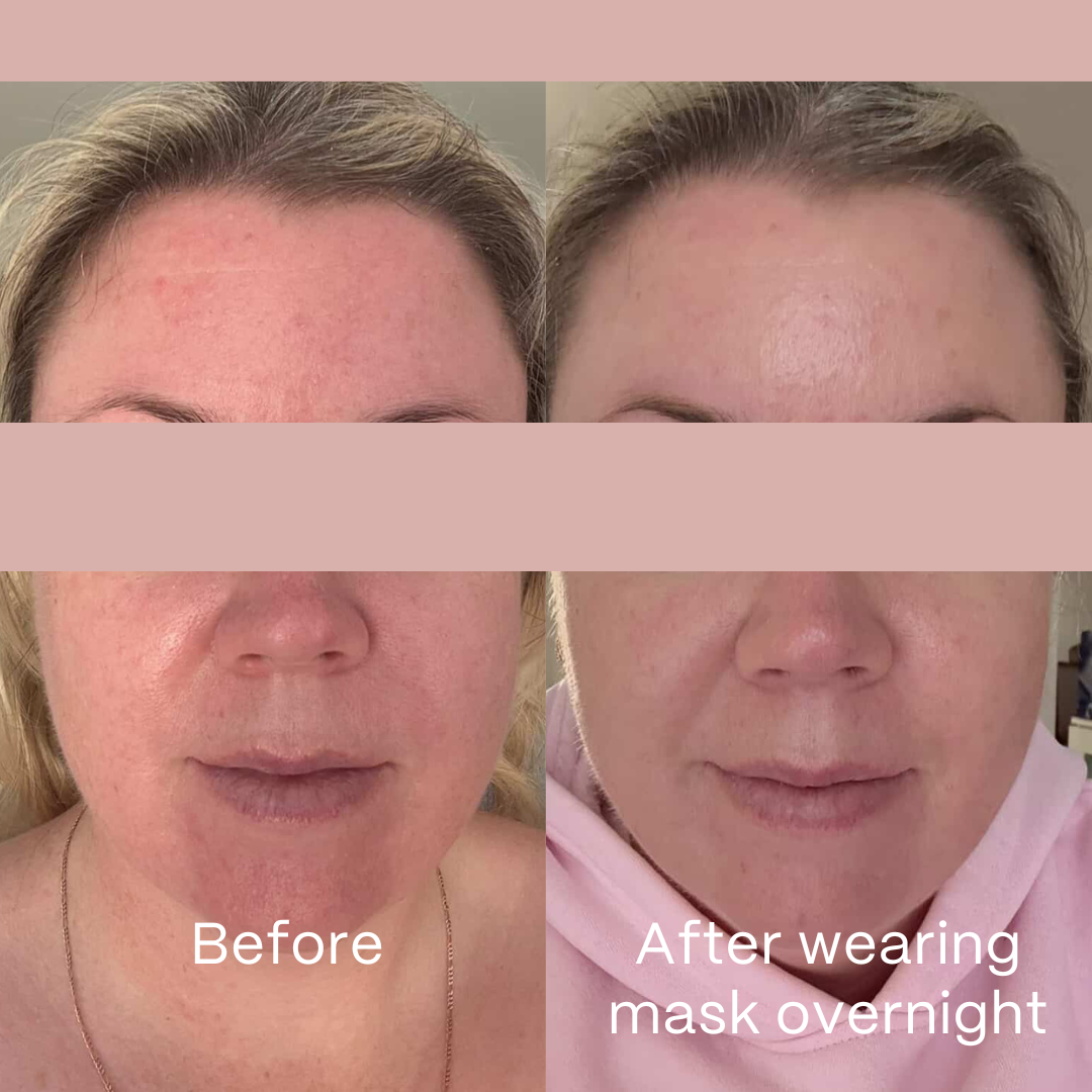 Glow Hydrogel Face Masks