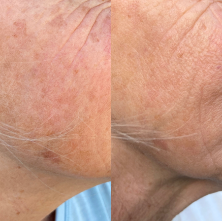 Glow Serum