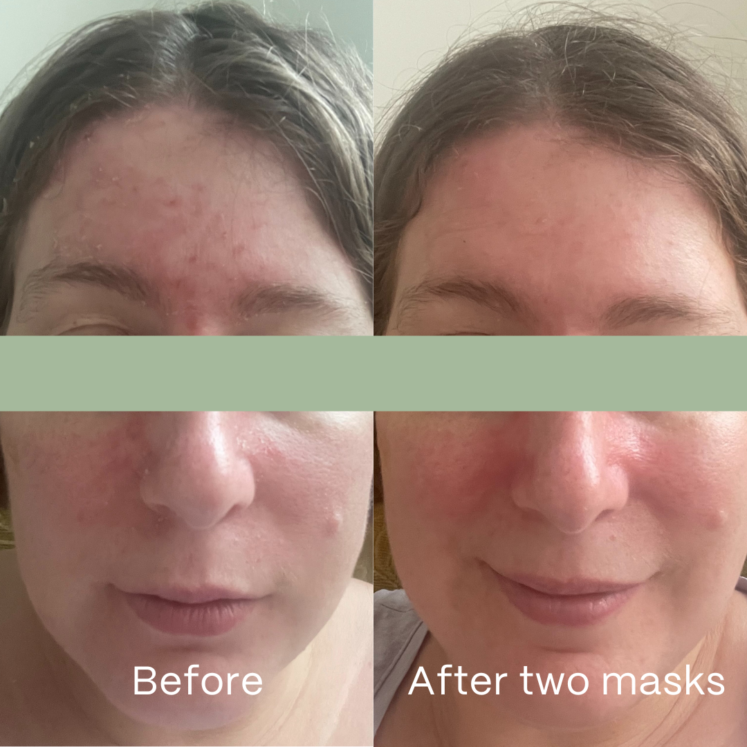 Soothe Hydrogel Face Masks