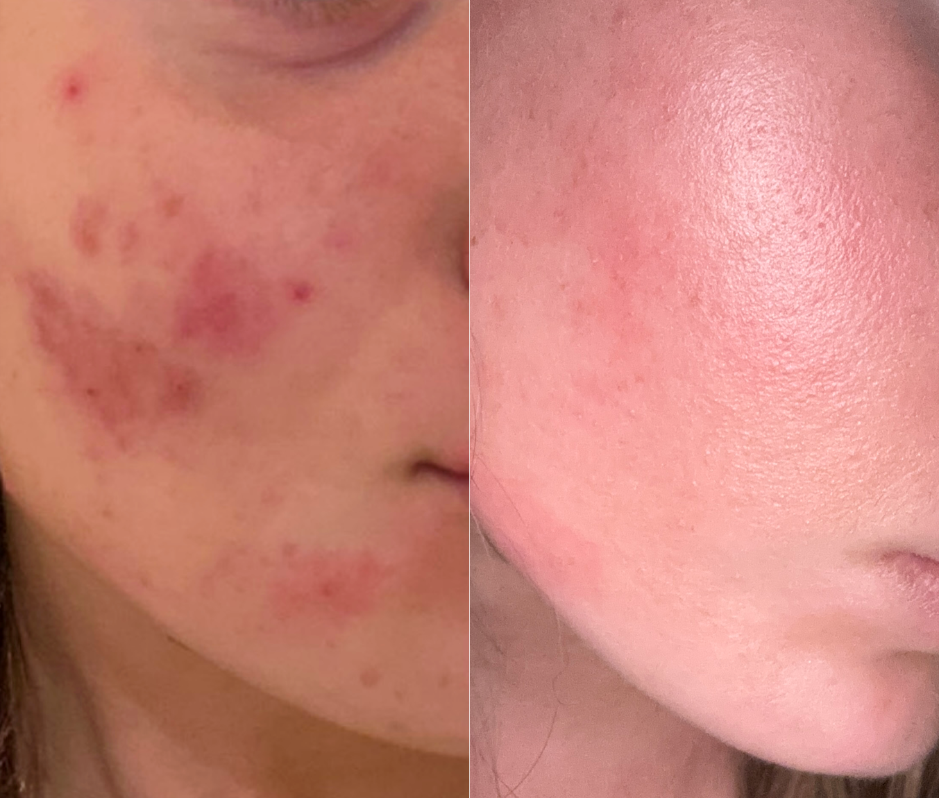 Soothe Serum