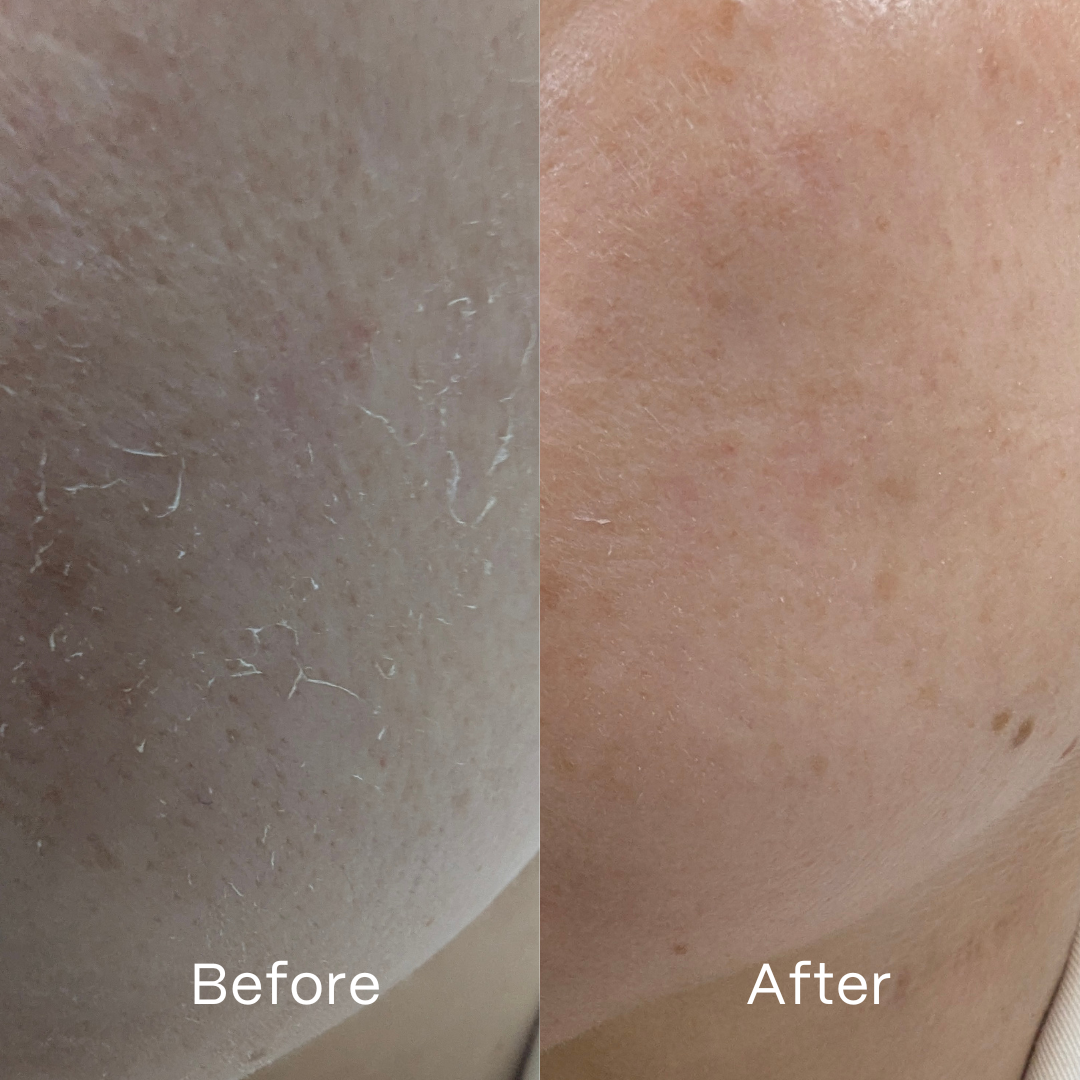 Soothe Hydrogel Face Masks