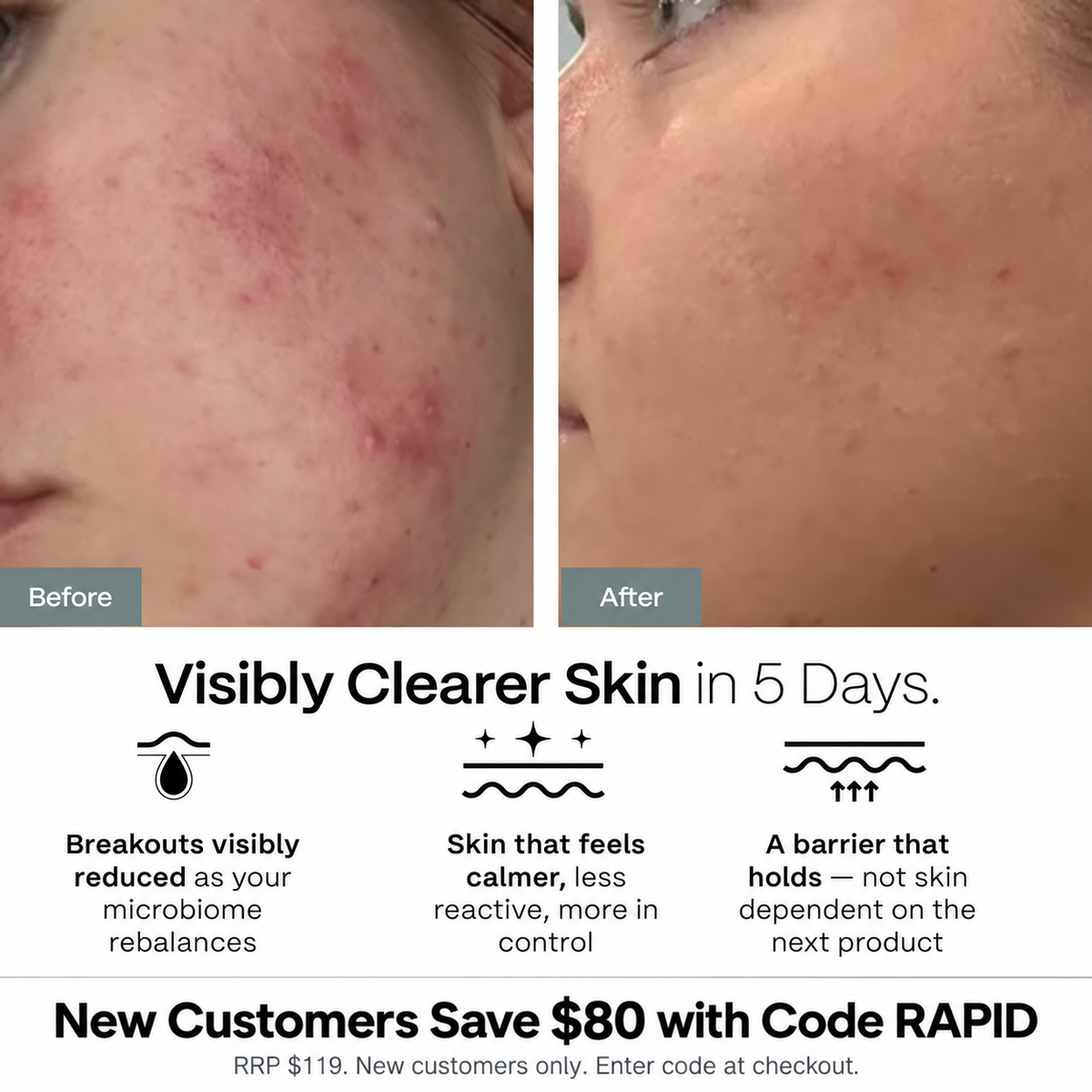 5-Day Rapid Results Kit