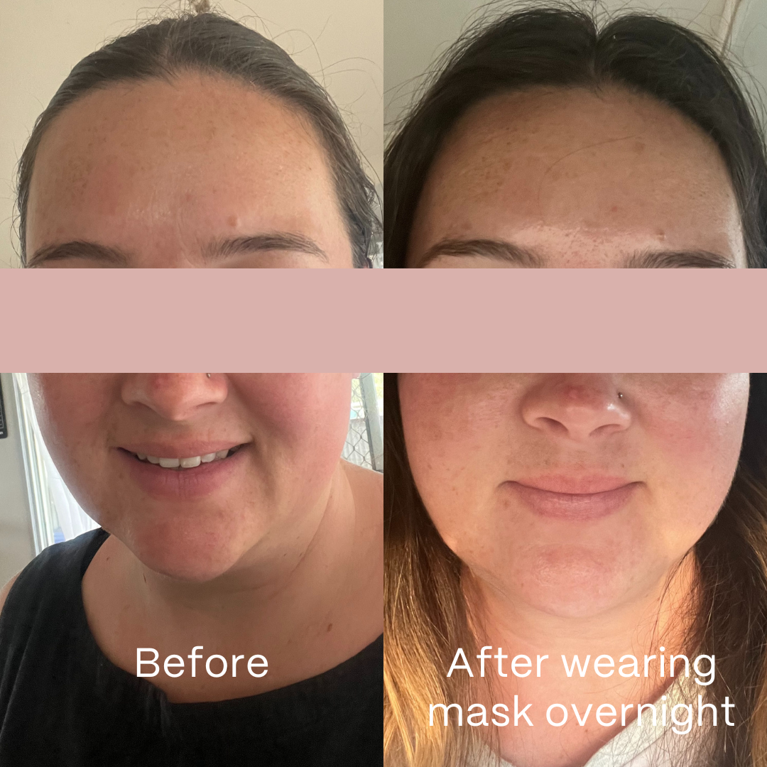 Glow Hydrogel Face Masks